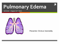 Pulmonary edema.pptx